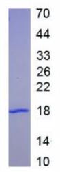 SDS-PAGE (KRT19-3263H).jpg